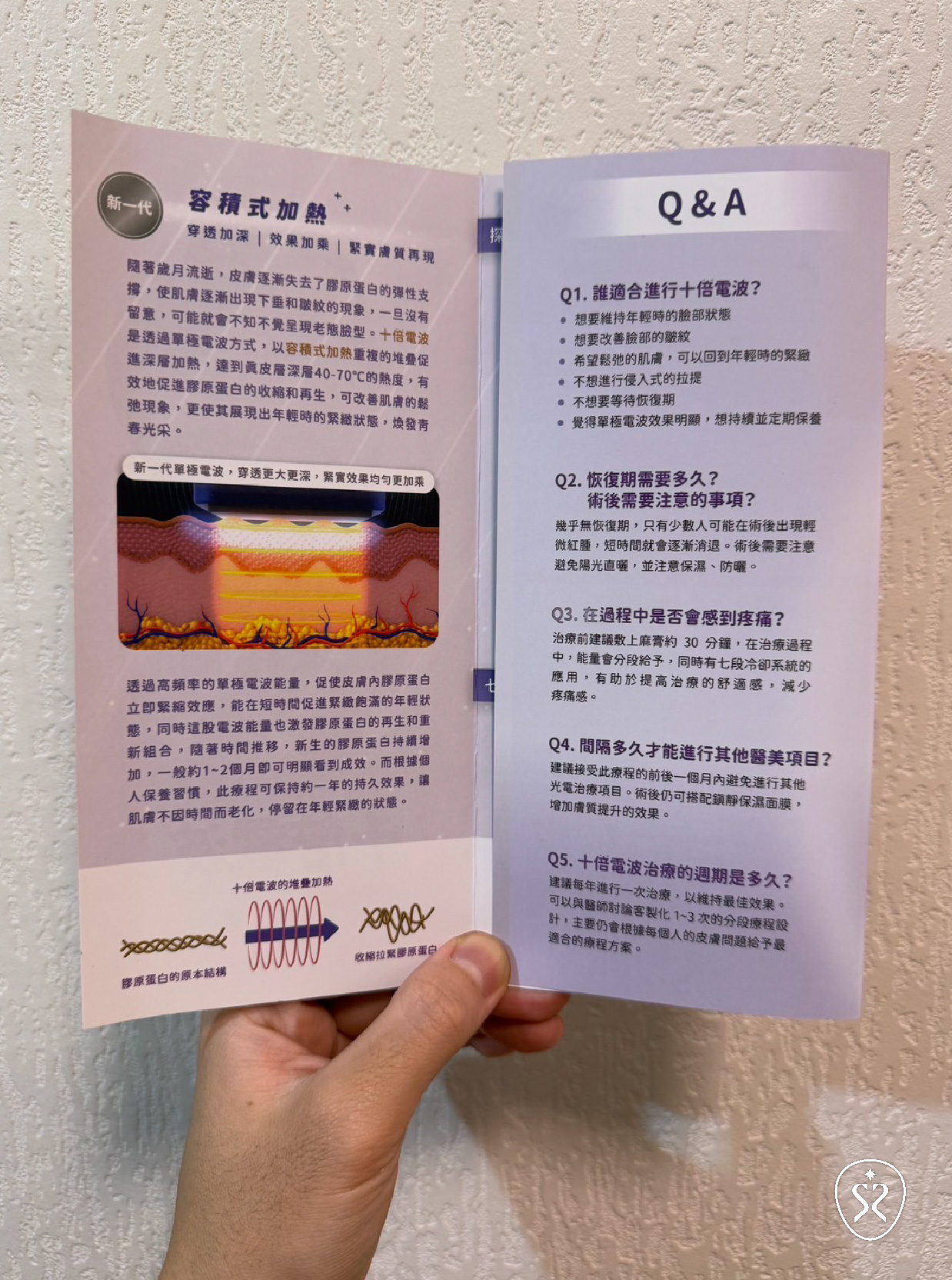 十蓓電波在第二週開始會漸漸看到治療的成效，效果大約可以維持8-12個月